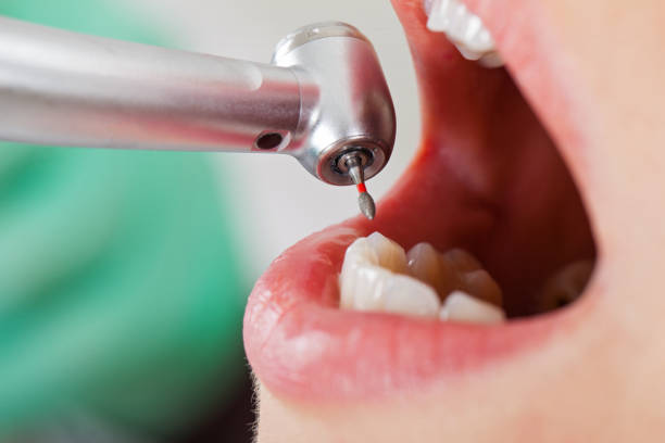 Best Emergency Treatment for Jaw Pain or Injury in Woodland, WA